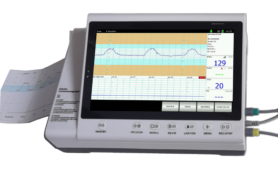Близнецы больницы зондируют монитор тарифа сердца CTG фетальный с принтером