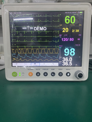 Монитор 12,1 дюймов оборудования больницы медицинский терпеливый с Multiparameters СО2