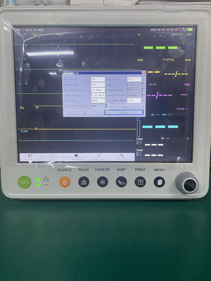 12.1-дюймовый цветной TFT LCD мультипараметрический монитор пациента с гарантией 1 год и компактным дизайном 30*27*30 см